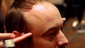 Tips for Balding Men