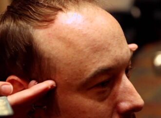 Tips for Balding Men